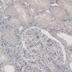 Tyrosine Hydroxylase Antibody (CL3049), Novus Biologicals:Antibodies:Primary