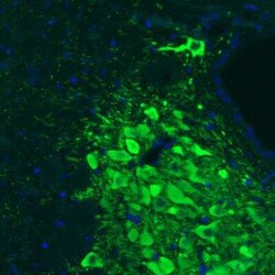 Tyrosine Hydroxylase Antibody (CL3049), Novus Biologicals:Antibodies:Primary