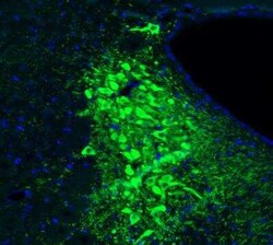 Tyrosine Hydroxylase Antibody (CL3049), Novus Biologicals:Antibodies:Primary