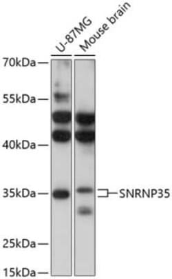 U11/U12-35K Antibody - Azide and BSA Free, Novus Biologicals:Antibodies:Primary