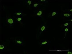 U2AF2 Antibody (5G8), Novus Biologicals 0.1 mg | Buy Online | Novus Biologicals | Fisher Scientific