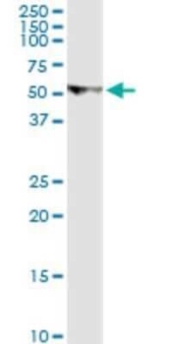 U2AF2 Antibody (5G8), Novus Biologicals 0.1 mg | Buy Online | Novus Biologicals | Fisher Scientific
