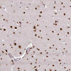 U2AF35 Antibody, Novus Biologicals 25 &mu;L, Unconjugated:Antibodies, Polyclonal
