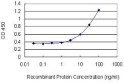 UAP1 Antibody (3A9), Novus Biologicals 0.1 mg | Buy Online | Novus Biologicals | Fisher Scientific