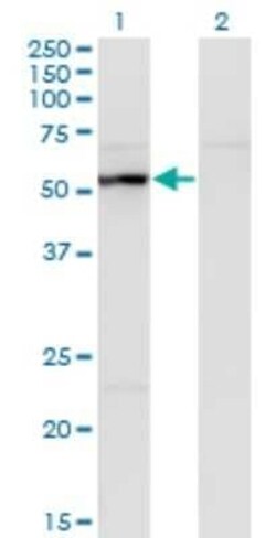 UAP1 Antibody (3A9), Novus Biologicals 0.1 mg | Buy Online | Novus Biologicals | Fisher Scientific