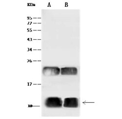 UBA52 Antibody, Novus Biologicals 100 &mu;g; Unconjugated:Antibodies, Polyclonal