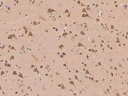 UBAP2L Antibody, Novus Biologicals:Antibodies:Primary Antibodies