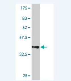 UBE2D4/Ubch5d Antibody (3E1), Novus Biologicals 0.1 mg | Buy Online | Novus Biologicals | Fisher Scientific