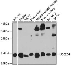 UBE2D4/Ubch5d Antibody - BSA Free, Novus Biologicals 0.1 mL, Unconjugated:Antibodies,