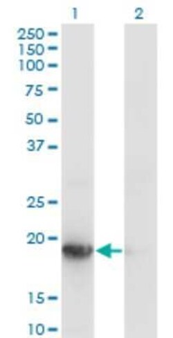 UBE2G1 Antibody (1C12-1B2), Novus Biologicals 0.1 mg | Buy Online | Novus Biologicals | Fisher Scientific