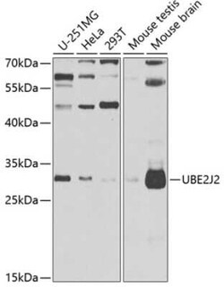 UBE2J2/UBC6 Antibody - BSA Free, Novus Biologicals 0.02 mL | Buy Online | Novus Biologicals | Fisher Scientific