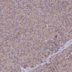 UBE2N/Ubc13 Antibody, Novus Biologicals 25 &mu;L | Buy Online | Novus Biologicals | Fisher Scientific