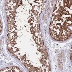 UBE2N/Ubc13 Antibody, Novus Biologicals 25 &mu;L | Buy Online | Novus Biologicals | Fisher Scientific