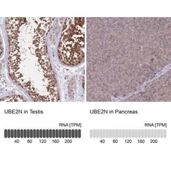 UBE2N/Ubc13 Antibody, Novus Biologicals 25 &mu;L | Buy Online | Novus Biologicals | Fisher Scientific