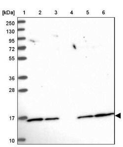 UBE2N/Ubc13 Antibody, Novus Biologicals 25 &mu;L | Buy Online | Novus Biologicals | Fisher Scientific