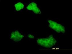 UBE2Q2 Antibody (2H3), Novus Biologicals 0.1 mg; Unconjugated:Antibodies,