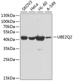 UBE2Q2 Antibody - BSA Free, Novus Biologicals 0.1 mL; Unconjugated:Antibodies,