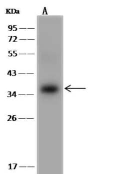 UBE2R1/CDC34 Antibody, Novus Biologicals 50 &mu;g; Unconjugated:Antibodies,