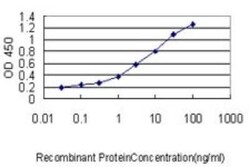 UBE2R2 Antibody (5E7), Novus Biologicals 0.1 mg | Buy Online | Novus Biologicals | Fisher Scientific