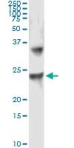 UBE2T Antibody (1E12-4A3), Novus Biologicals 0.1 mg | Buy Online | Novus Biologicals | Fisher Scientific