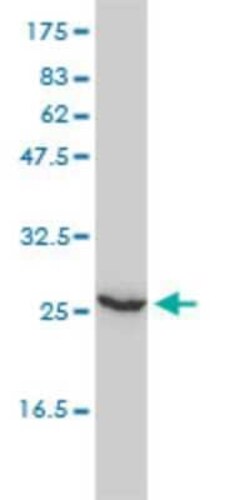UBE2T Antibody (1E12-4A3), Novus Biologicals 0.1 mg | Buy Online | Novus Biologicals | Fisher Scientific