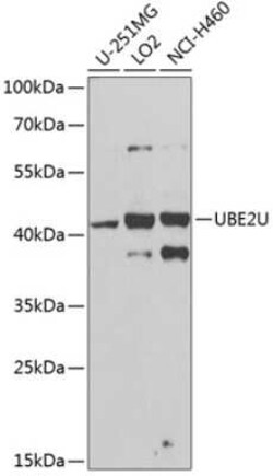 UBE2U Antibody - BSA Free, Novus Biologicals 0.02 mL; Unconjugated:Antibodies,