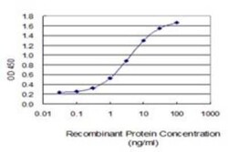 UBE2W Antibody (7G4), Novus Biologicals 0.1 mg | Buy Online | Novus Biologicals | Fisher Scientific