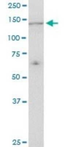 UBE4A Antibody (1G8), Novus Biologicals 0.1 mg; Unconjugated:Antibodies,