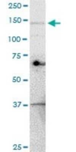 UBE4A Antibody (1G8), Novus Biologicals 0.1 mg; Unconjugated:Antibodies,