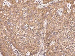 UBE4A Antibody, Novus Biologicals 50 &mu;g, Unconjugated:Antibodies, Polyclonal