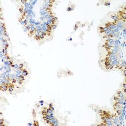 UBIAD1 Antibody - BSA Free, Novus Biologicals:Antibodies:Primary Antibodies