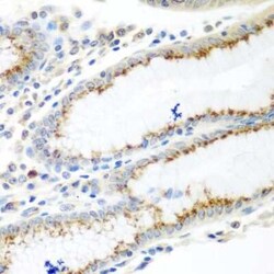 UBIAD1 Antibody - BSA Free, Novus Biologicals:Antibodies:Primary Antibodies