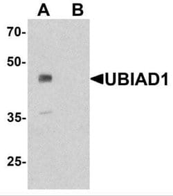 UBIAD1 Antibody - BSA Free, Novus Biologicals 0.1 mg; Unconjugated:Antibodies,