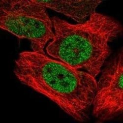 UBN1 Rabbit anti-Human, Polyclonal, Novus Biologicals 25 &mu;g; Unconjugated:Antibodies,