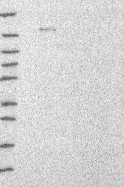 UBN1 Rabbit anti-Human, Polyclonal, Novus Biologicals 25 &mu;g; Unconjugated:Antibodies,