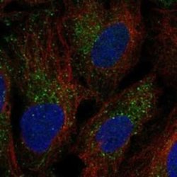 UBR1 Rabbit anti-Human, Polyclonal, Novus Biologicals 25 &mu;g; Unconjugated:Antibodies,