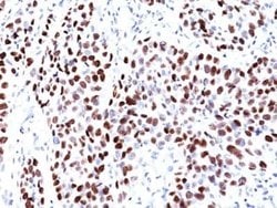 UBR2 Antibody (PCRP-UBR2-1D12) - Azide and BSA Free, Novus Biologicals 100 &mu;g | Buy Online | Novus Biologicals | Fisher Scientific