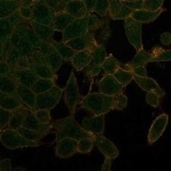 UBR2 Mouse anti-Human, Clone: PCRP-UBR2-1D12, Novus Biologicals:Antibodies:Primary