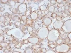 UBR2 Mouse anti-Human, Clone: PCRP-UBR2-1D12, Novus Biologicals:Antibodies:Primary