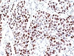 UBR2 Mouse anti-Human, Clone: PCRP-UBR2-1D12, Novus Biologicals:Antibodies:Primary