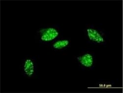 UBR2 Antibody (4G4), Novus Biologicals 100 &mu;g | Buy Online | Novus Biologicals | Fisher Scientific
