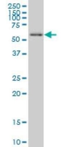 UBR4 Antibody (2D12), Novus Biologicals 0.1 mg | Buy Online | Novus Biologicals | Fisher Scientific