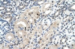 UBR7 Antibody, Novus Biologicals 100 &mu;L; Unconjugated:Antibodies, Polyclonal