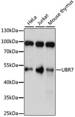 UBR7 Antibody - Azide and BSA Free, Novus Biologicals:Antibodies:Primary