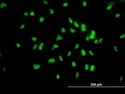 UBTF Antibody (1A2), Novus Biologicals 0.1 mg | Buy Online | Novus Biologicals | Fisher Scientific