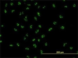UBTF Antibody (6B6), Novus Biologicals 0.1 mg | Buy Online | Novus Biologicals | Fisher Scientific