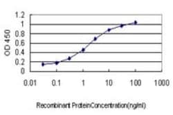 UBTF Antibody (6B6), Novus Biologicals 0.1 mg | Buy Online | Novus Biologicals | Fisher Scientific