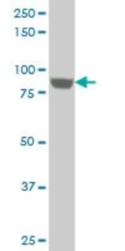 UBTF Antibody (6C6), Novus Biologicals 0.1 mg | Buy Online | Novus Biologicals | Fisher Scientific