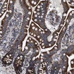 UBXN8 Antibody, Novus Biologicals 25 &mu;L; UBXN8 Antibody; Unconjugated:Antibodies,