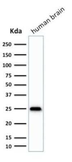 UCH-L1/PGP9.5 Mouse, Clone: SPM575, Novus Biologicals 0.02mg; Unlabeled:Antibodies,